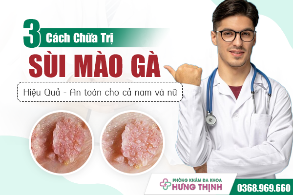 3 Cách Chữa Sùi Mào Gà Hiệu Quả, An Toàn Cho Cả Nam Và Nữ Giới