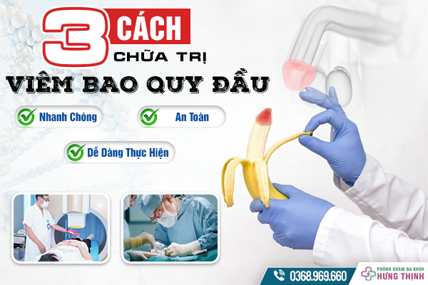 3 Cách Chữa Trị Viêm Bao Quy Đầu Nhanh Chóng, An Toàn Và Dễ Dàng Thực Hiện