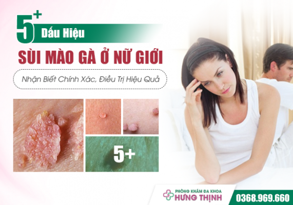 5+ Dấu Hiệu Sùi Mào Gà Ở Nữ Giới Thường Gặp: Nhận Biết Chính Xác, Điều Trị Hiệu Quả