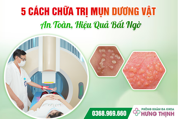 5 Cách Chữa Trị Mụn Dương Vật An Toàn, Hiệu Quả Bất Ngờ