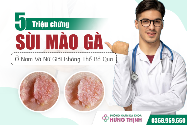 5 Triệu Chứng Sùi Mào Gà Ở Nam Và Nữ Giới Không Thể Bỏ Qua