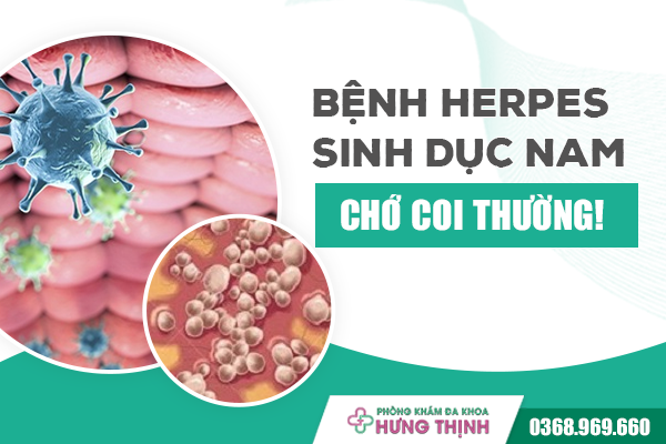 Bệnh Herpes sinh dục nam- chớ coi thường !