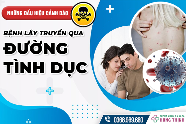 Biểu hiện của bệnh lây qua đường tình dục và cách phòng ngừa