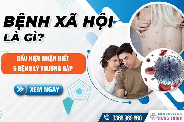 Bệnh Xã Hội Là Gì? Dấu Hiệu Nhận Biết 5 Bệnh Lý Thường Gặp