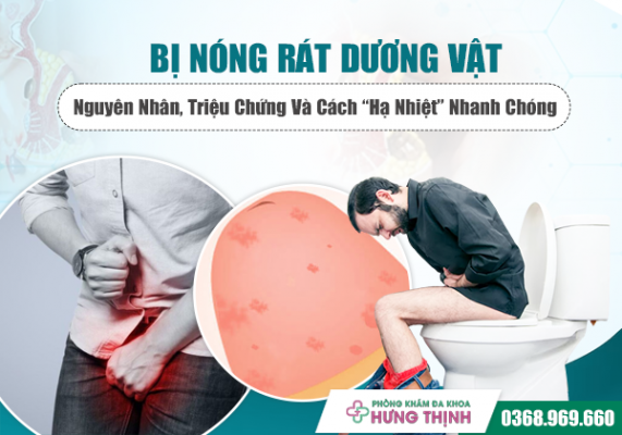 Bị Nóng Rát Dương Vật: Nguyên Nhân, Triệu Chứng Và Cách “Hạ Nhiệt” Nhanh Chóng, Hiệu Quả