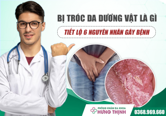 Bị Tróc Da Dương Vật Là Gì? Tiết Lộ 6 Nguyên Nhân Gây Bệnh Và Cách Xử Lý Hiệu Quả