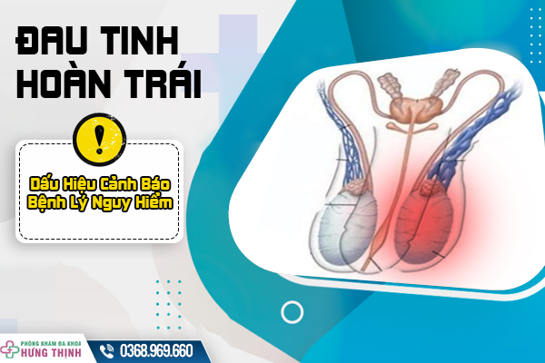 Bị Đau Tinh Hoàn Bên Trái: Dấu Hiệu Cảnh Báo Bệnh Lý Nguy Hiểm - Cần Phải Làm Gì?