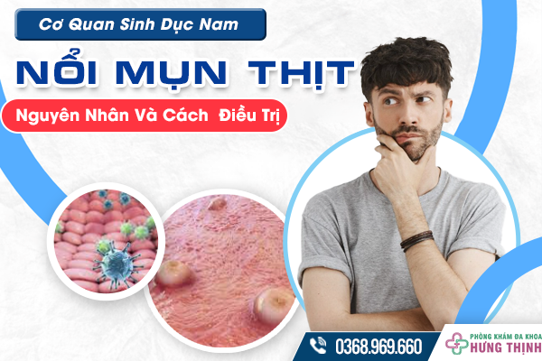 Cơ Quan Sinh Dục Nam Nổi Mụn Thịt Có Làm Sao Không? Nguyên Nhân Và Cách  Điều Trị