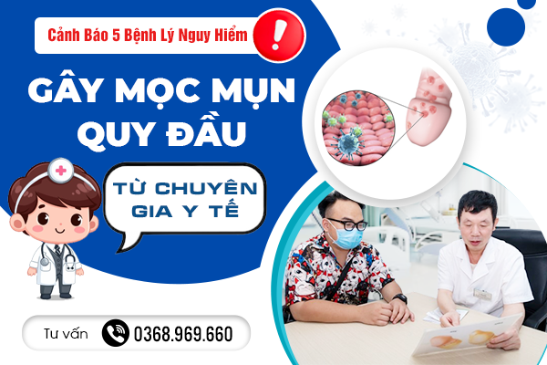 Cảnh Báo 5 Bệnh Lý Nguy Hiểm Gây Mọc Mụn Ở Quy Đầu Từ Chuyên Gia Y Tế