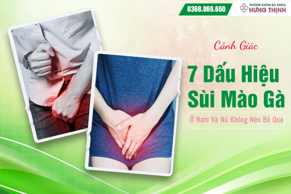 Cảnh Giác 7 Dấu Hiệu Sùi Mào Gà Ở Nam Và Nữ Không Nên Bỏ Qua