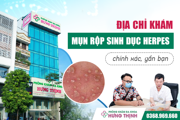 Địa chỉ khám mụn rộp sinh dục Herpes chính xác, gần bạn 