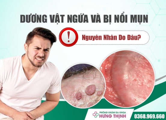 Dương Vật Ngứa Và Bị Nổi Mụn Nguyên Nhân Do Đâu?
