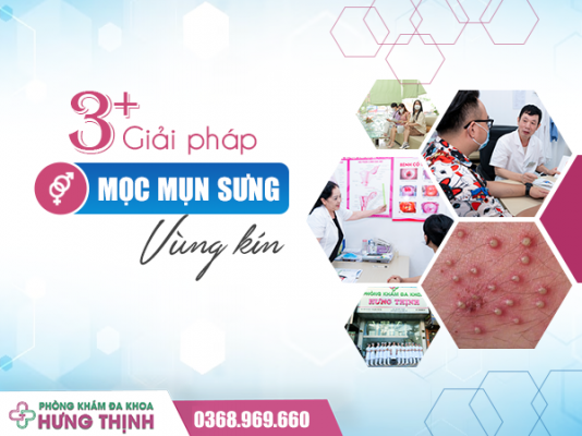 3+ Giải Pháp Hiệu Quả Cho Tình Trạng Mọc Mụn Sưng Ở Vùng Kín