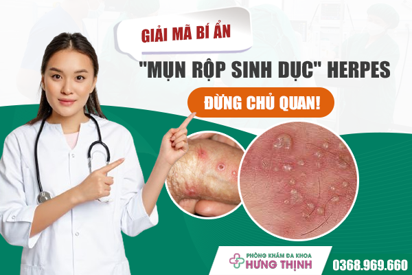 Giải mã bí ẩn 