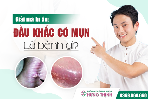 Giải mã bí ẩn: Đầu khấc có mụn là bệnh gì?