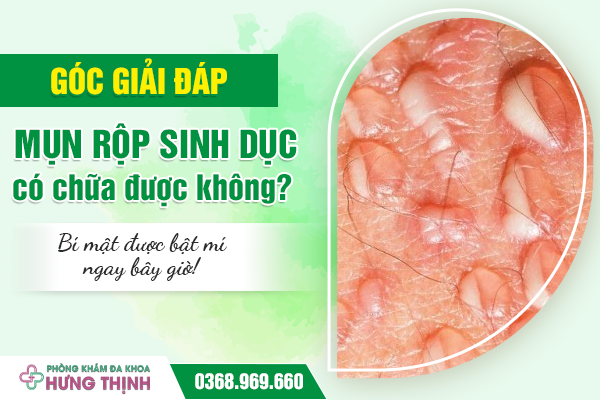 [GÓC GIẢI ĐÁP] Mụn rộp sinh dục có chữa được không? Bí mật được bật mí ngay bây giờ!