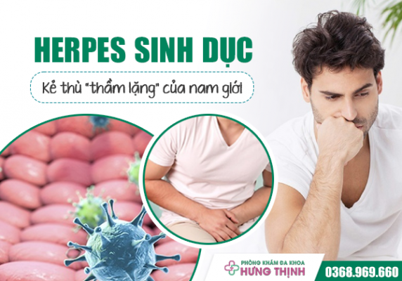 Herpes sinh dục - 