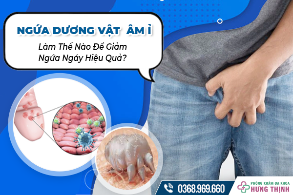 Hiện Tượng Ngứa Dương Vật  Âm Ỉ, Dai Dẳng Là Bệnh Gì? Làm Thế Nào Để Giảm Ngứa Ngáy Hiệu Quả?