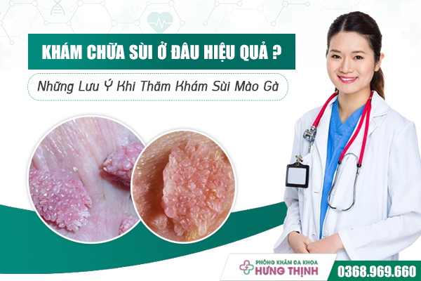 Khám Chữa Sùi Ở Đâu Hiệu Quả Và An Toàn? Những Lưu Ý Khi Thăm Khám Sùi Mào Gà