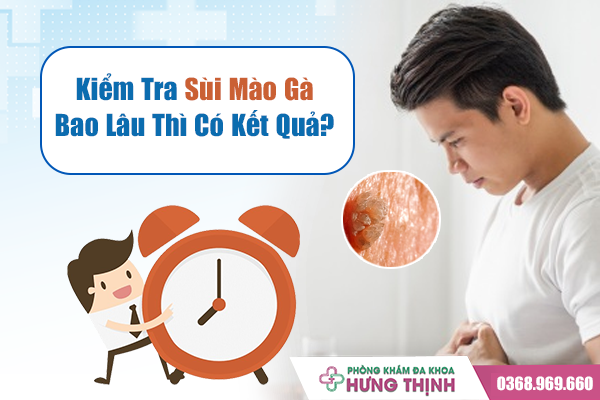 Kiểm Tra Sùi Mào Gà Bao Lâu Thì Có Kết Quả? 