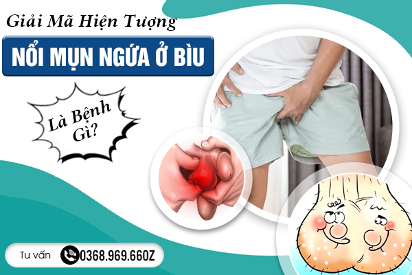 Lý Giải Hiện Tượng Mụn Thịt Mọc Ở Bìu Cậu Nhỏ: Nguyên Nhân Và Bí Quyết Điều Trị Nhanh Chóng, Đơn Giản