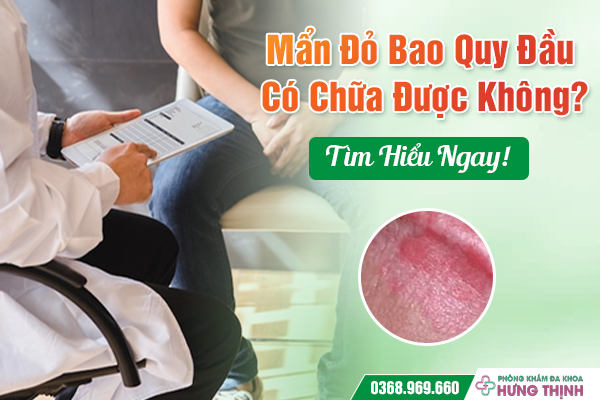 Mẩn Đỏ Bao Quy Đầu Có Chữa Được Không? Tìm Hiểu Ngay!