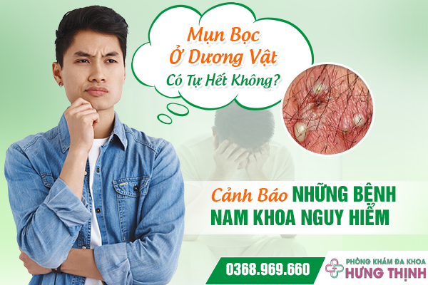 Mụn Bọc Ở Dương Vật Có Tự Hết Không? Cảnh Báo Những Bệnh Nam Khoa Nguy Hiểm