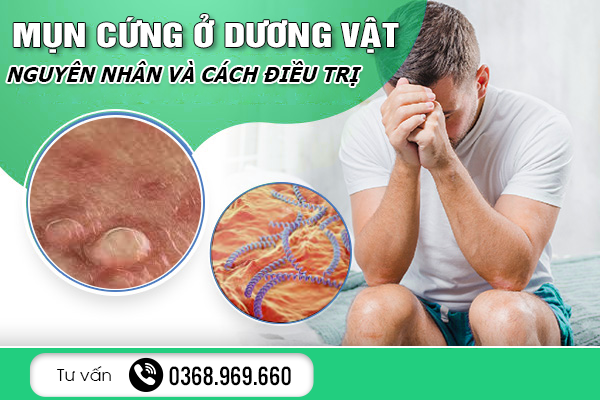 Mụn Cứng Ở Dương Vật Là Gì? Nguyên Nhân Và Cách Điều Trị