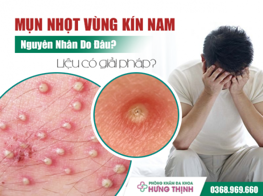 Mụn Nhọt Vùng Kín Nam Nguyên Nhân Do Đâu? Liệu Có Giải Pháp?