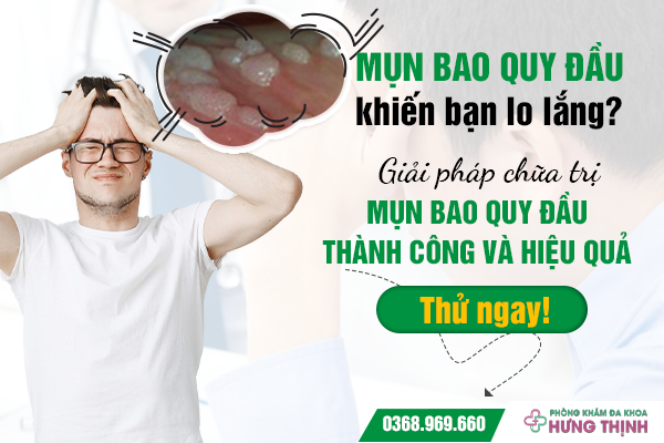 Mụn bao quy đầu khiến bạn lo lắng? Giải pháp chữa trị mụn bao quy đầu thành công và hiệu quả. Thử ngay!