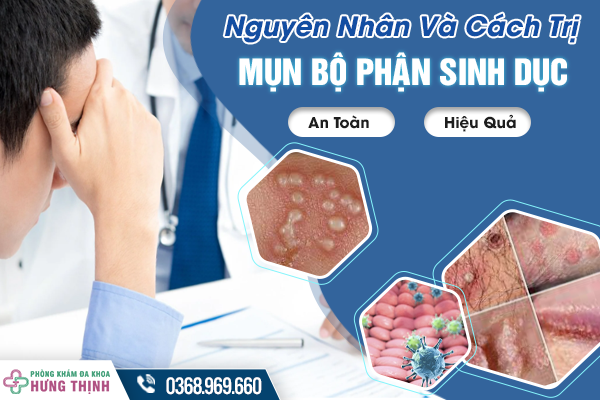 Nguyên Nhân Và Cách Trị Mụn Ở Bộ Phận Sinh Dục An Toàn, Hiệu Quả