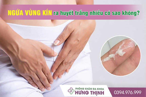 Ngứa vùng kín huyết trắng nhiều có sao không? Điều trị như thế nào?