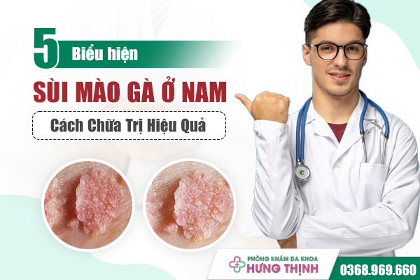 Nhận Biết 5 Biểu Hiện Sùi Mào Gà Nam Giới Sớm Và Cách Chữa Hiệu Quả