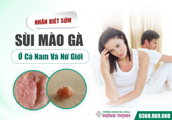 Nhận Biết Sớm, Chính Xác Hiện Tượng Bị Sùi Mào Gà Ở Cả Nam Và Nữ Giới
