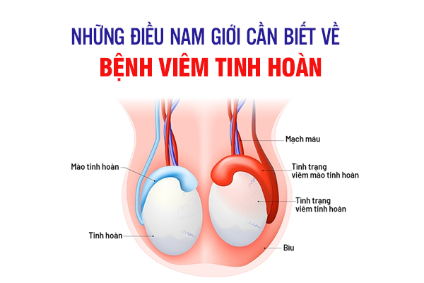 Những Điều Nam Giới Cần Biết Về Bệnh Viêm Tinh Hoàn