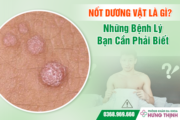 Nốt Dương Vật Là Gì? Những Bệnh Lý Bạn Cần Phải Biết