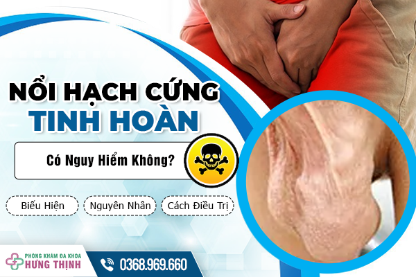 Nổi Hạch Cứng Tinh Hoàn Có Nguy Hiểm Không? Biểu Hiện, Nguyên Nhân Và Cách Điều Trị