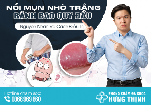  Nổi Mụn Nhỏ Trắng Ở Rãnh Bao Quy Đầu: Nguyên Nhân Và Cách Điều Trị