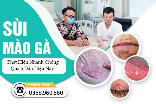 Phát Hiện Sùi Mào Gà Giai Đoạn Đầu Nhanh Chóng Qua 5 Dấu Hiệu Này