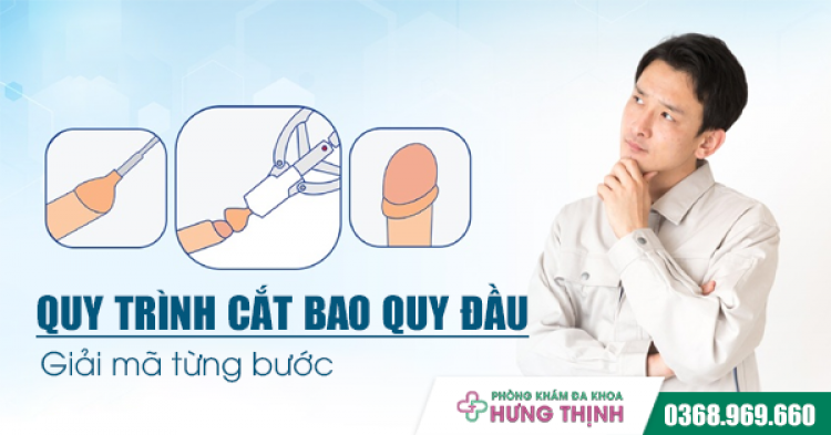 Quy trình cắt bao quy đầu: Giải mã từng bước