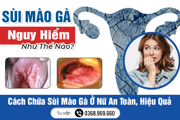 Sùi Mào Gà Nguy Hiểm Như Thế Nào? Cách Chữa Sùi Mào Gà Ở Nữ An Toàn, Hiệu Quả