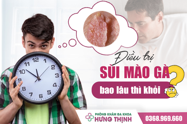 Thời Gian Điều Trị Bệnh Sùi Mào Gà Bao Lâu Thì Khỏi?