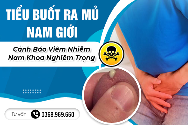  Tiểu Buốt Ra Mủ Ở Nam Giới Là Biểu Hiện Bệnh Gì? Cảnh Báo Viêm Nhiễm Nam Khoa Nghiêm Trọng