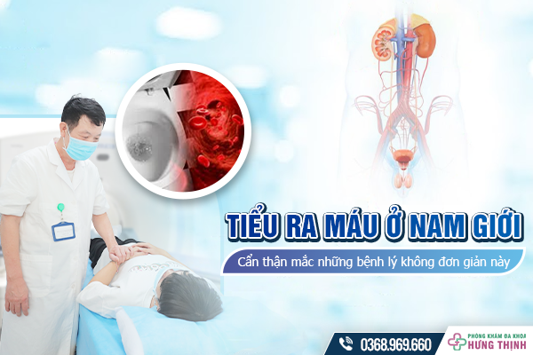 Tiểu ra máu ở nam giới: Cẩn thận mắc những bệnh lý không đơn giản này