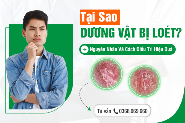 Tại Sao Dương Vật Bị Loét? Nguyên Nhân Và Cách Điều Trị Hiệu Quả