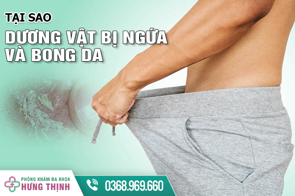 Tại Sao Dương Vật Bị Ngứa Và Bong Da? Làm Sao Để Khắc Phục?