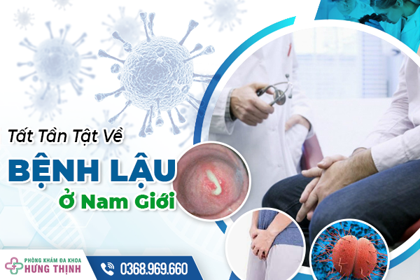 Tất Tần Tật Về Bệnh Lậu Ở Nam Giới - Phát Hiện Sớm, Điều Trị Kịp Thời