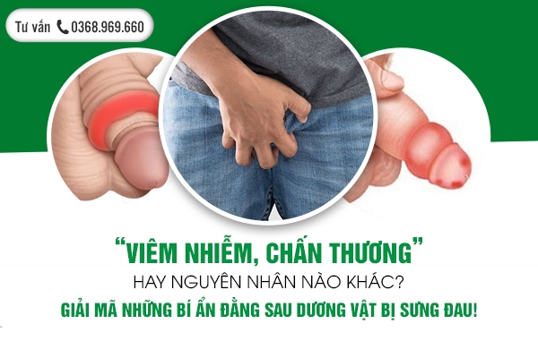 “Viêm nhiễm, chấn thương” hay nguyên nhân nào khác? Giải mã những bí ẩn đằng sau dương vật bị sưng đau!