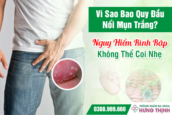 Vì Sao Bao Quy Đầu Nổi Mụn Trắng? Nguy Hiểm Rình Rập Không Thể Coi Nhẹ