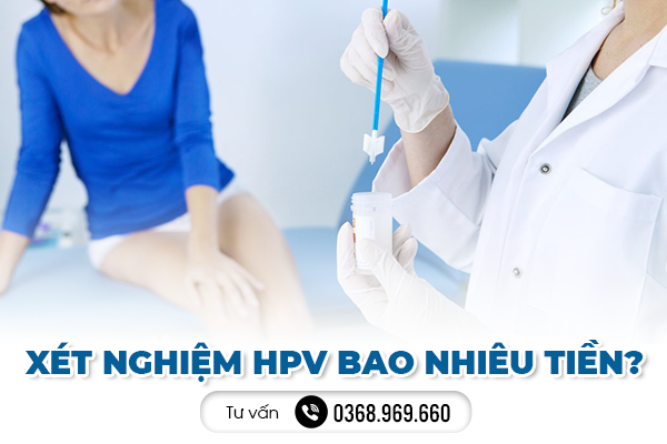 [Giải đáp] Xét nghiệm HPV bao nhiêu tiền?